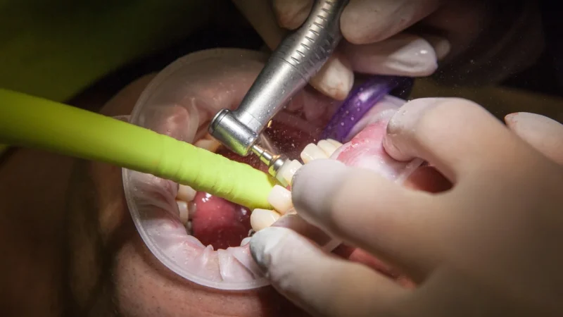 Dlaczego dentysta nie jest lekarzem