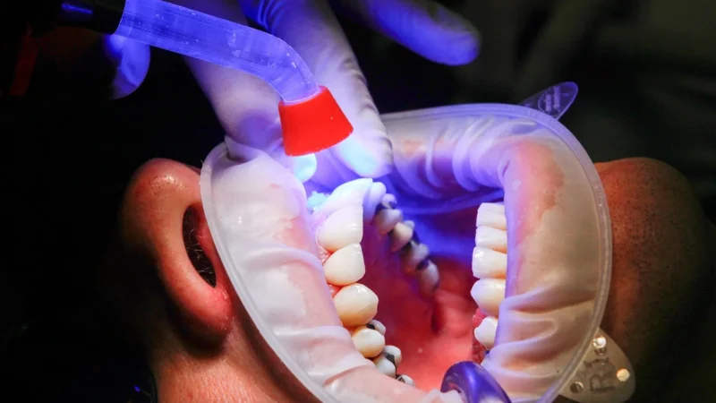 Kto lepiej zarabia dentysta czy lekarz